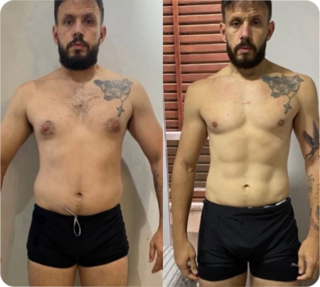 Antes e Depois Homens 1