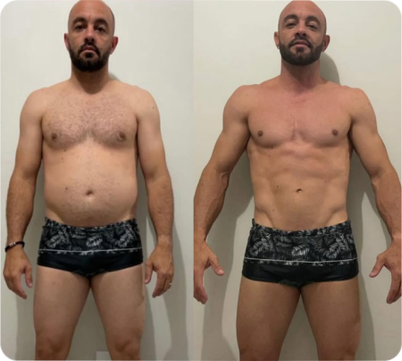Antes e Depois Homens 11