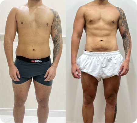 Antes e Depois Homens 12