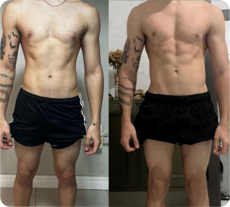 Antes e Depois Homens 3