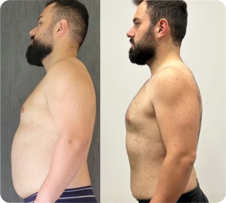 Antes e Depois Homens 5