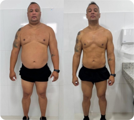 Antes e Depois Homens 7