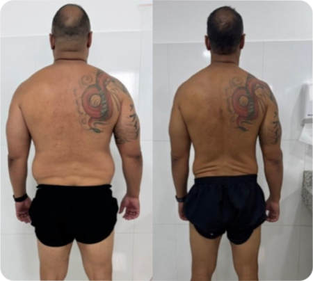 Antes e Depois Homens 8