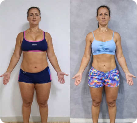 Antes e Depois Mulher 1