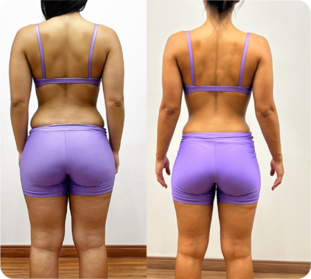 Antes e Depois Mulher 10