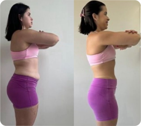 Antes e Depois Mulher 11