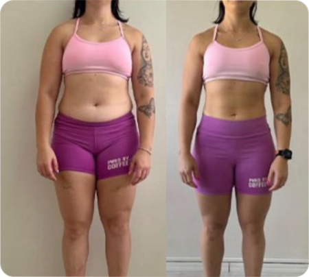 Antes e Depois Mulher 12