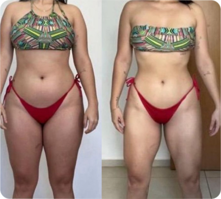 Antes e Depois Mulher 13