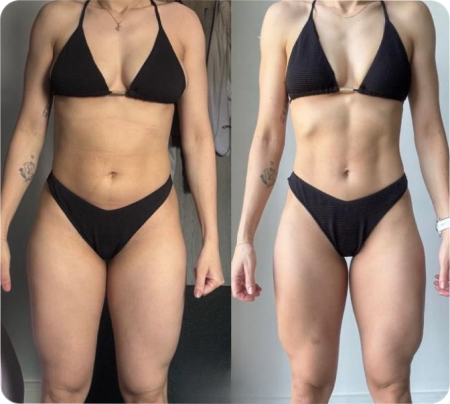 Antes e Depois Mulher 4