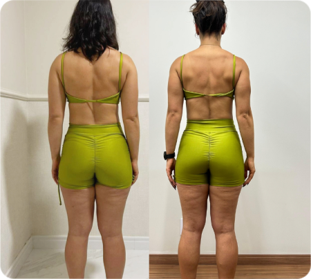 Antes e Depois Mulher 6