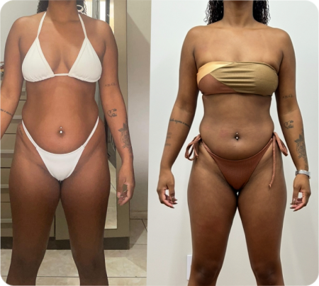 Antes e Depois Mulher 7