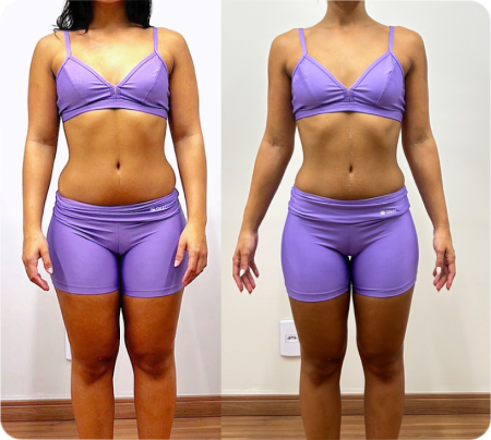Antes e Depois Mulher 9